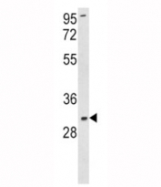 Western blot analysis of SOD3 antibody and K562 lysate. Predicted molecular weight: 26~32 kDa.