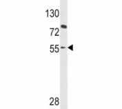 Western blot analysis of PAX8 antibody and HL-60 lysate. Predicted molecular weight ~48kDa but also observed at 55-60 kDa.