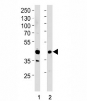 Western blot analysis of lysate from (1) HepG2 cell line and (2) human lung tissue lysate using RAGE antibody at 1:1000. Predicted molecular weight: 45-55kDa depending on glycosylation level.