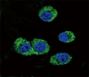 Confocal immunofluorescent analysis of RAGE antibody with MDA-MB231 cells followed by Alexa Fluor 488-conjugated goat anti-rabbit lgG (green). DAPI was used as a nuclear counterstain (blue).