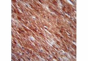 IL-2 antibody immunohistochemistry analysis in formalin fixed and paraffin embedded mouse heart tissue.~