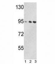 Western blot analysis of VCP antibody and 1) Jurkat, 2) 293, and 3) MDA-MB231 lysate. Predicted/observed molecular weight: ~89/97kDa.