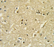 IHC analysis of FFPE human brain tissue stained with PAX6 antibody