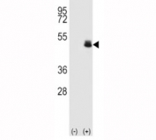 Western blot analysis of PAX-6 antibody and 293 cell lysate (2 ug/lane) either nontransfected (Lane 1) or transiently transfected (2) with the human gene.