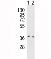 Western blot analysis of OGG1 antibody and human HeLa (lane 1), mouse NIH3T3 (2) lysate. Predicted molecular weight ~38kDa.