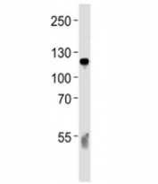 Western blot analysis of lysate from human blood plasma tissue lysate using C6 antibody diluted at 1:1000 for each lane.