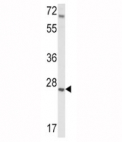 Western blot analysis of IGFBP4 antibody and mouse lung tissue lysate. Predicted molecular weight: ~28kDa.