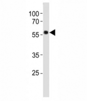 TH antibody western blot analysis in SH-SY5Y lysate. Predicted molecular weight 55~60 kDa.