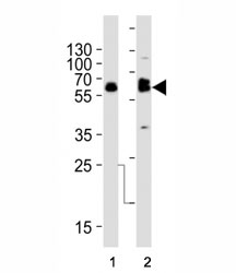 Western blot analysis of lysate from (1) SW480 and (2) U-87 MG cell line using TH antibody at 1:1000. Predicted molecular weight ~60 kDa.