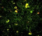 Immunofluorescence analysis of Rab5 antibody with paraffin-embedded human brain tissue. Primary antibody was followed by FITC-conjugated goat anti-rabbit lgG. FITC emits green fluorescence. Red counterstaining is PI.