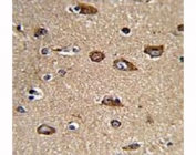 IHC analysis of FFPE human brain tissue with Rab5 antibody