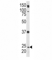 Western blot analysis of Rab5 antibody and HL-60 lysate.
