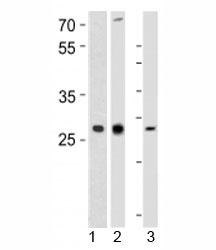 Western blot analysis of 1) human CEM, 2) rat PC-12, and 3) mouse spleen tissue lysate using LIF antibody at 1:1000.
