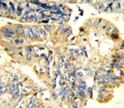 Flow cytometric analysis of CEM cells using LIF antibody (green) compared to a negative control (blue). FITC-conjugated goat-anti-rabbit secondary Ab was used for the analysis.