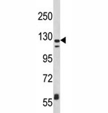 Western blot analysis of CD11c antibody and MDA-MB231 lysate. Predicted size: 128~150 kDa