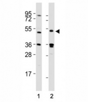 Western blot testing of LAG3 antibody at 1:2000 dilution tested on lysates from Lane 1: 293T; 2: human spleen; Predicted molecular weight ~54 kDa.