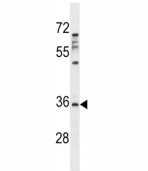 Aurora-C antibody western blot analysis in MDA-MB231 lysate. Predicted molecular weight ~33 kDa.