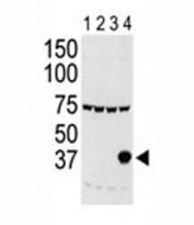 Western blot testing of Aurora-C antibody and lysate of 293 cells expressing 1) Flag tag, 2) Flag-tagged -A, 3) -B and 4) Aurora-C.