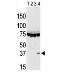 Western blot testing of Aurora-C antibody and lysate of 293 cells expressing 1) Flag tag, 2) Flag-tagged -A, 3) -B and 4) Aurora-C. ~