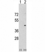 Western blot analysis of Aurora-A antibody and 293 cell lysate either nontransfected (Lane 1) or transiently transfected with the Aurora-A gene (2). Predicted molecular weight ~45 kDa.