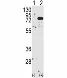 Western blot analysis of PKC beta antibody and 293 cell lysate either nontransfected (Lane 1) or transiently transfected with the PRKCB gene (2).~