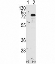 Western blot analysis of PKC beta antibody and 293 cell lysate either nontransfected (Lane 1) or transiently transfected with the PRKCB gene (2).