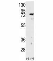 Western blot analysis of PKC delta antibody and 293 cell lysate either nontransfected (Lane 1) or transiently transfected with the PRKCD gene (2).