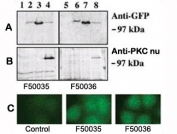 A. Western blot analysis of GFP fusion protein expression in Panc-1 cells by using an anti-GFP antibody. Lanes 1 and 5: non-transfected cells; lanes 2 and 6: PKD-transfected cells; lanes 3 and 7: PKD2-transfected cells; lanes 4 and 8: PKC nu transfected cells. B. Western blot analysis of GFP fusion protein expression in Panc-1 cells by using PKC nu antibodies. C. Indirect immunofluorescence analysis of PKC nu fusion protein expression in Panc-1 cells. Data courtesy of Dr. Osvaldo Rey, University of California Los Angeles.