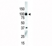 Western blot analysis of PKC nu antibody and NCI-H460 cell lysate