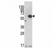 Western blot analysis of AKT1 antibody and 293 cell lysate (2 ug/lane) either nontransfected (Lane 1) or transiently transfected with the AKT1 gene (2).