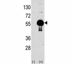 Western blot analysis of AKT2 antibody and 293 lysate transiently transfected with the human gene (2ug/lane).