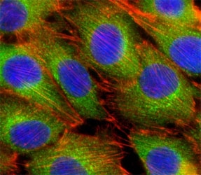 Fluorescent confocal image of C2C12 cells stained with AKT2 antibody at 1:25. Immunoreactivity is localized to the cytoplasm.