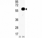 Western blot analysis of AKT2 antibody and 293 cell lysate (2 ug/lane) either nontransfected (Lane 1) or transiently transfected with the human gene (2). Predicted molecular weight: ~56kDa.