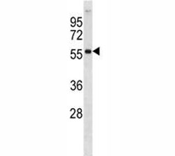 AKT2 antibody western blot analysis in 293 lysate