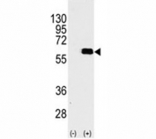 Western blot analysis of AKT2 antibody and 293 cell lysate (2 ug/lane) either nontransfected (Lane 1) or transiently transfected with the AKT2 gene (2). Predicted molecular weight: ~56kDa.