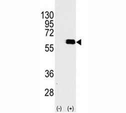 Western blot analysis of AKT2 antibody and 293 cell lysate (2 ug/lane) either nontransfected (Lane 1) or transiently transfected with the AKT2 gene (2).