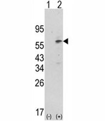 Western blot analysis of PDK1 antibody and 293 cell lysate (2 ug/lane) either nontransfected (Lane 1) or transiently transfected with the PDK1 gene (2).