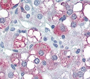 IHC analysis of FFPE human adrenal tissue stained with PDK4 antibody