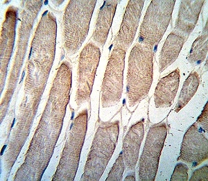 IHC analysis of FFPE human skeletal muscle stained with PDK4 antibody