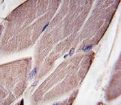 IHC analysis of FFPE human skeletal muscle tissue stained with PDK4
