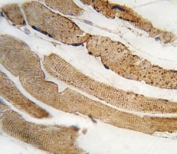 IHC analysis of FFPE human skeletal muscle tissue stained with PDK4 antibody