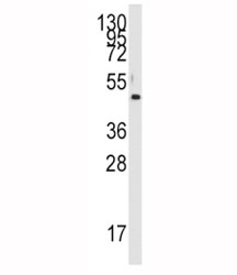 Western blot analysis of PDK4 antibody and HL-60 lysate. Predicted molecular weight ~46 kDa