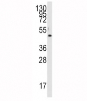 Western blot analysis of PDK4 antibody and HL-60 lysate.  Predicted molecular weight ~46 kDa.