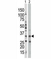AMPK beta 1 antibody used in western blot to detect PRKAB1 in Jurkat cell lysate (Lane 1) and mouse spleen tissue lysate (2).