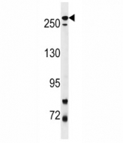 LRRK2 antibody western blot analysis in mouse lung tissue lysate