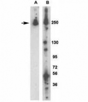 Western blot analysis of LRRK2 antibody: (A) 293 cells transiently transfected with the PARK8/LRRK2 gene; (B) mouse brain.