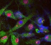 SY5Y cells stained for endogenous PARK8 (green), phosphorylated Tau (red), and DAPI nuclear staining.