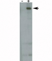 Western blot: Park8 antibody detecting over-expressed human LRRK2/PARK8 protein.