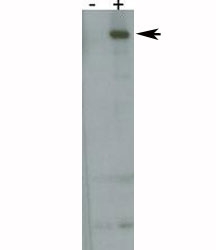 Park8 antibody detect over-expressed human LRRK2/PARK8 protein.