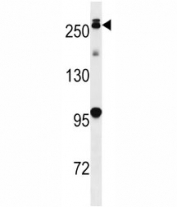 PARK8 antibody western blot analysis in mouse lung tissue lysate.